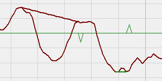 Divergence MACD